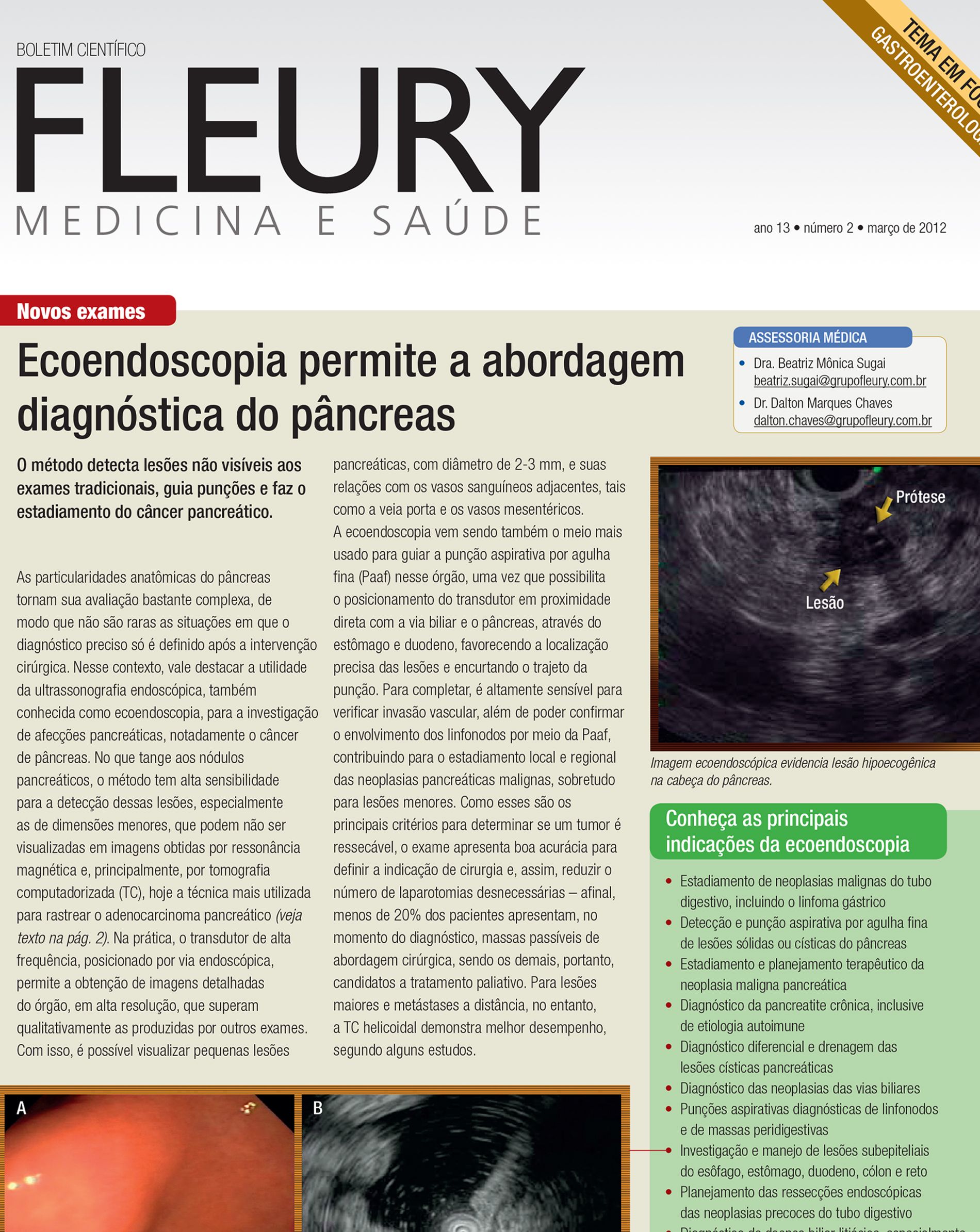 Ecoendoscopia (ultrassonografia endoscópica) na abordagem diagnóstica e estadiamento do câncer pancreático.